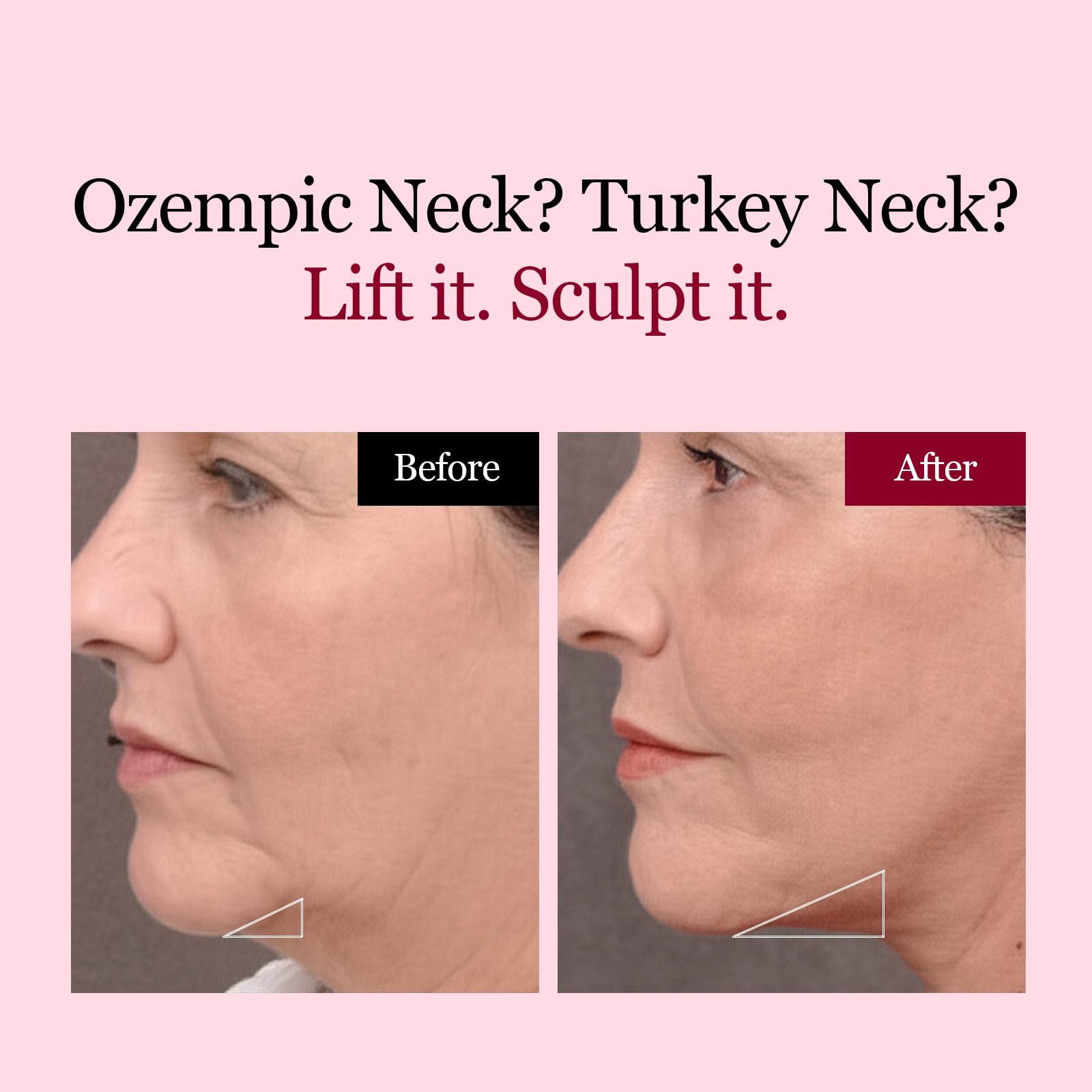 ROUND LAB Camellia Deep Collagen V Lifting Gel Mask 14ea | Double-chin Turkey Neck Instant Face Lifting Mask, Cooling and Depuffing Face Toning Belt, Firming Sagging Skin, Korean Skin Care, 10g/0.35oz