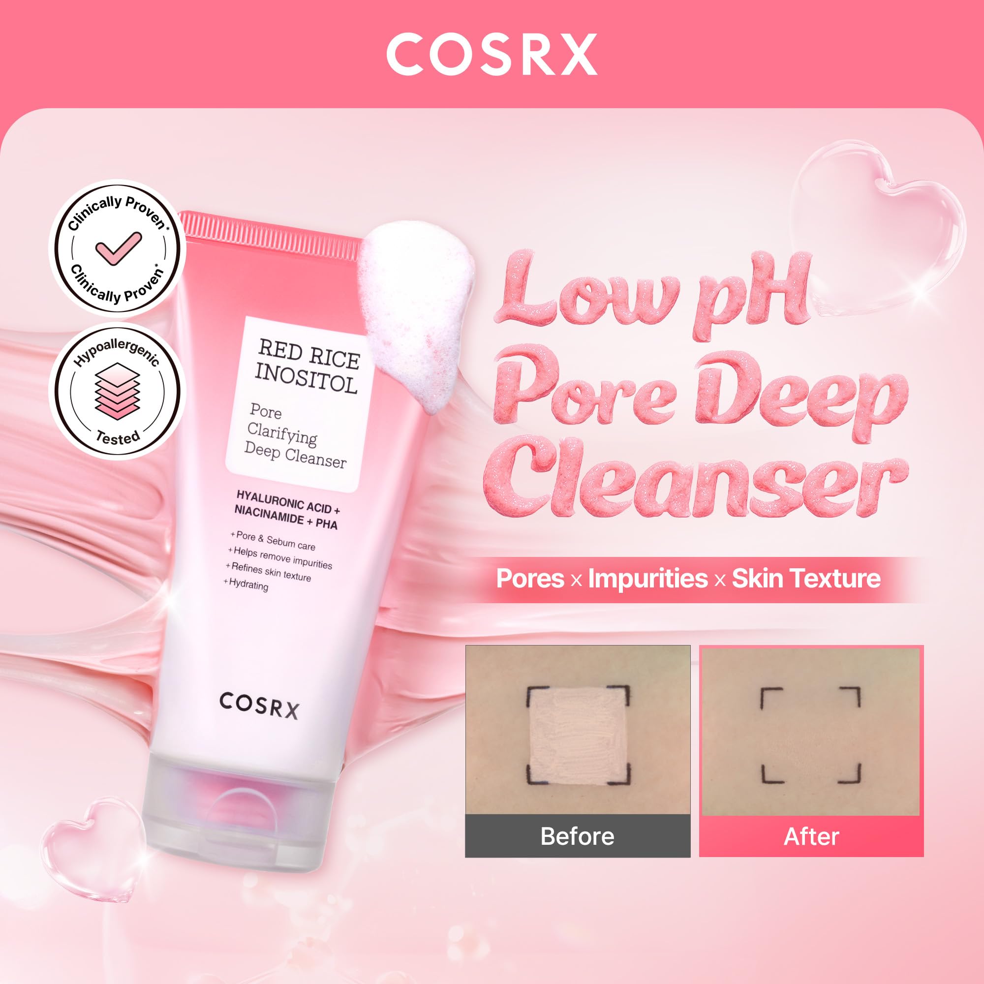 COSRX Low pH Pore Deep Cleanser, Gentle Blackheads Remover, 5.07 fl.oz