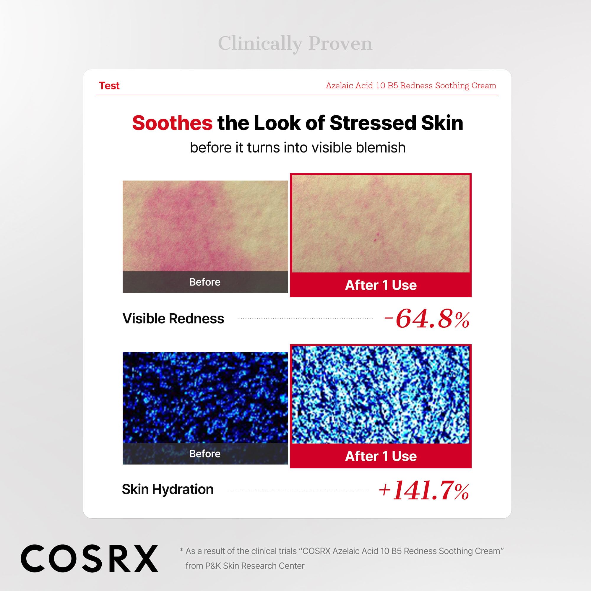 COSRX Azelaic Acid 10 B5 Redness Soothing Cream Gel, 1.01 fl oz.