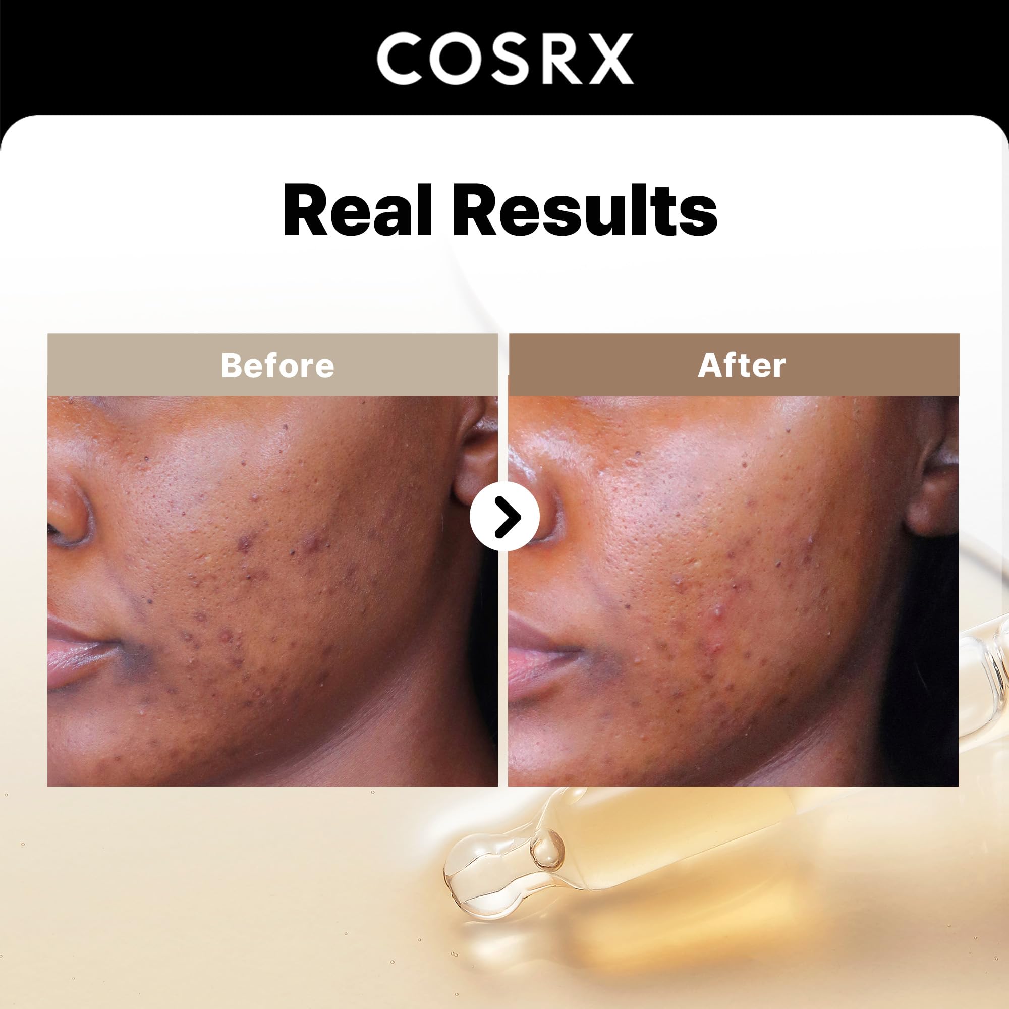 COSRX Serum Duo - 2% Alpha Arbutin Discoloration Care + 15% Niacinamide Face Serum