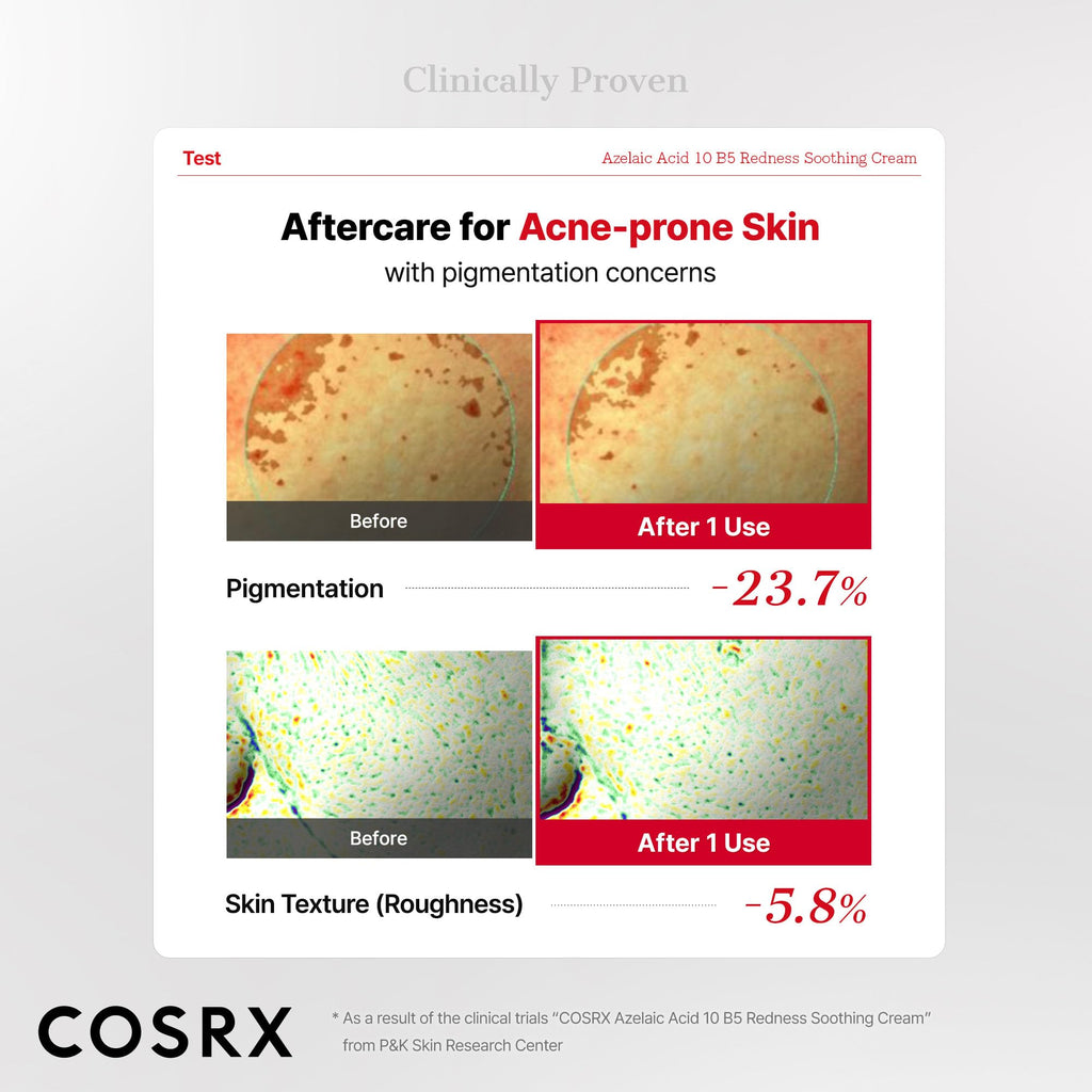COSRX Azelaic Acid 10 B5 Redness Soothing Cream Gel, 1.01 fl oz.