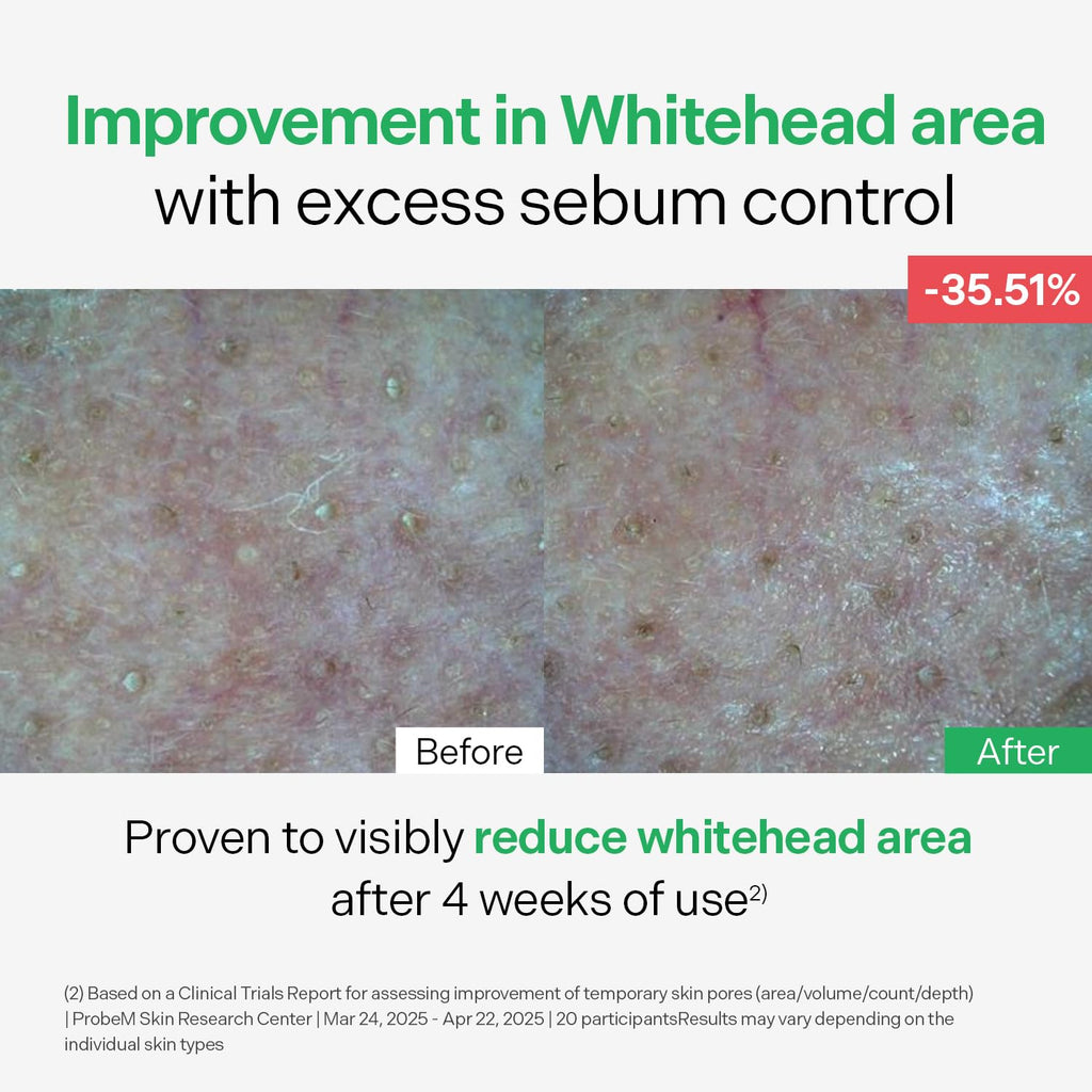 Torriden BALANCEFUL Control Serum 50ml (1.69 fl.oz.) | Daily Sebum & Oil Control for Sensitive Skin | 5D Complex Cica, 4% Niacinamide | Korean Facial Serum