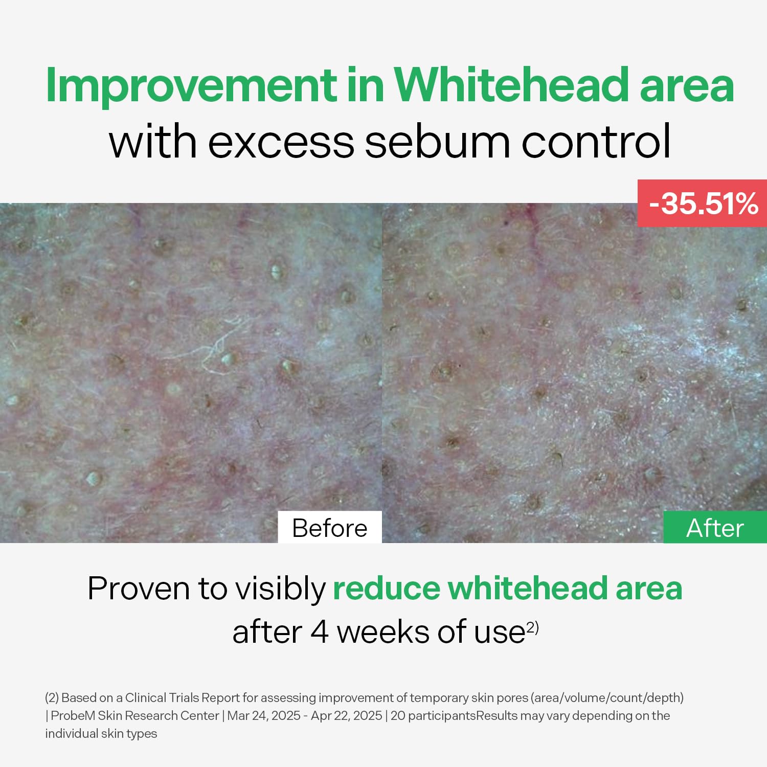 Torriden BALANCEFUL Control Serum 50ml (1.69 fl.oz.) | Daily Sebum & Oil Control for Sensitive Skin | 5D Complex Cica, 4% Niacinamide | Korean Facial Serum