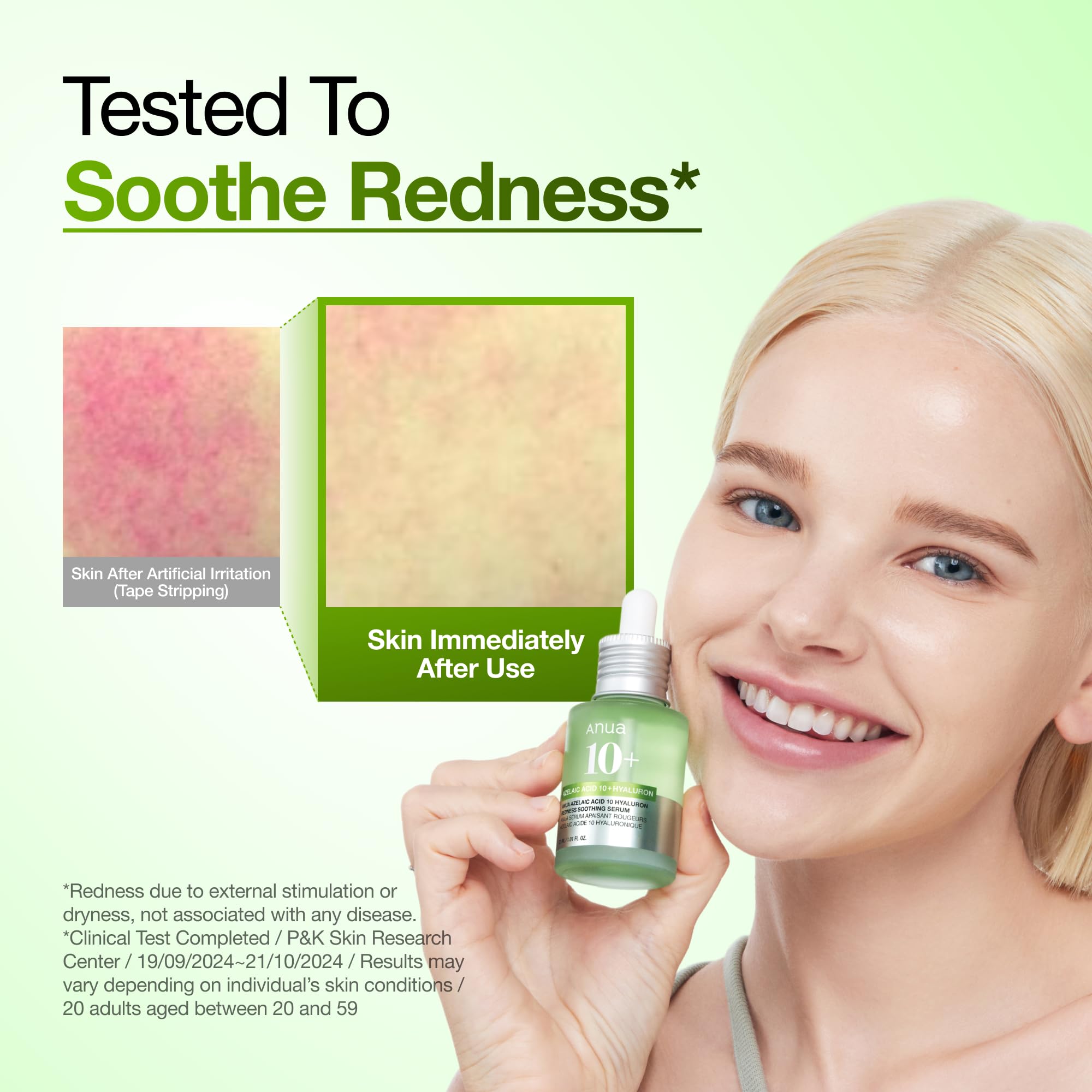 Anua Azelaic Acid 10 Hyaluron Redness Soothing Serum, 1.01 fl oz