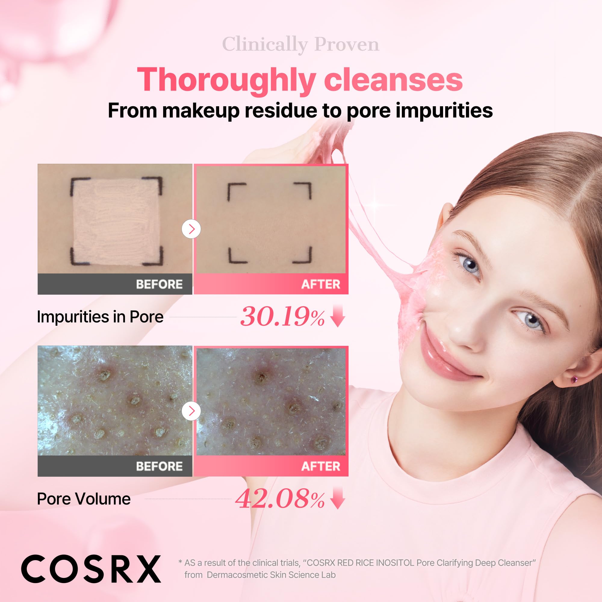 COSRX Low pH Pore Deep Cleanser, Gentle Blackheads Remover, 5.07 fl.oz