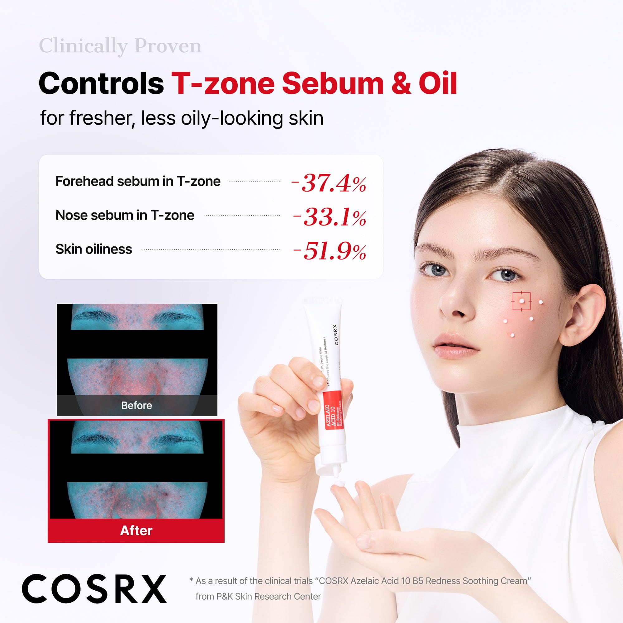 COSRX Azelaic Acid 10 B5 Redness Soothing Cream Gel, 1.01 fl oz.