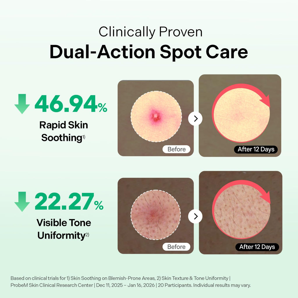 Torriden BALANCEFUL Azelaic Acid Micropoint Spot Patch (12 patches) | Blemish Care with Micropoints & 5D Cica | Redness & Post-Blemish Marks care | Korean Skincare