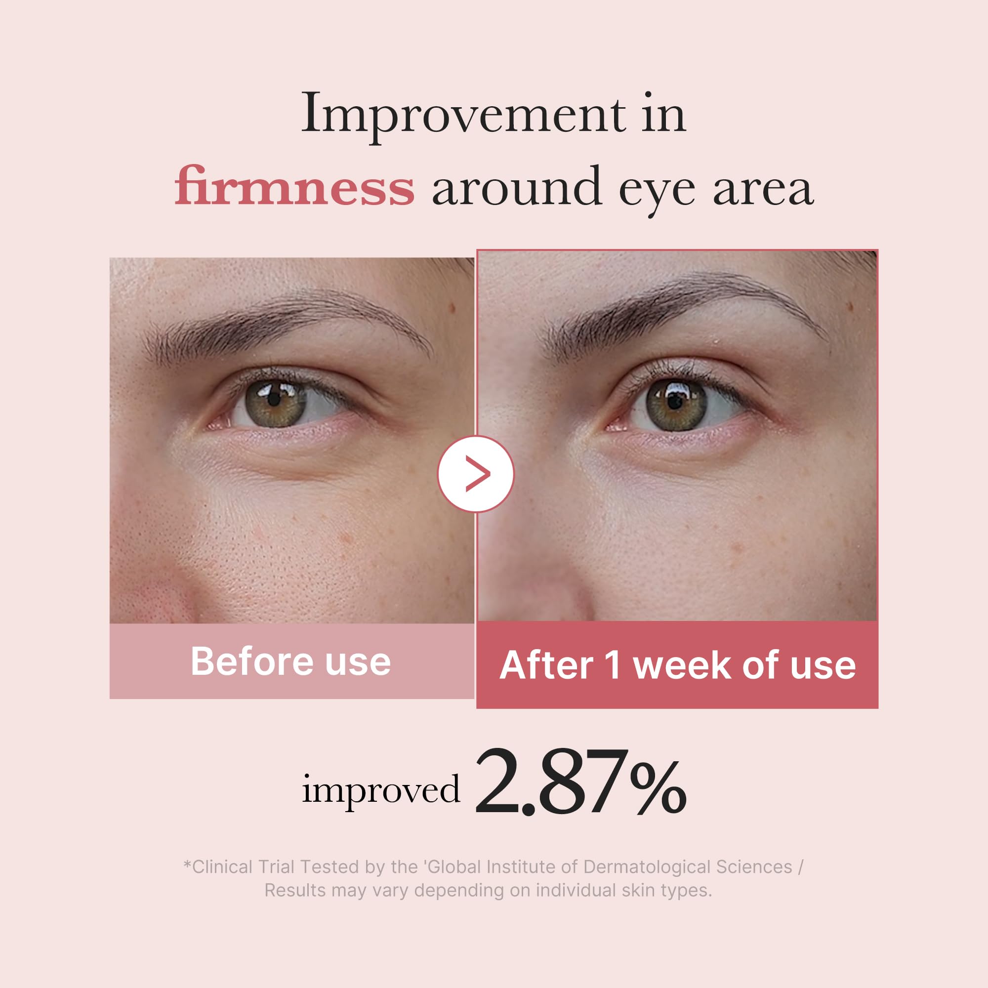 medicube Eye Serum with Salmon DNA PDRN & Pink Peptides