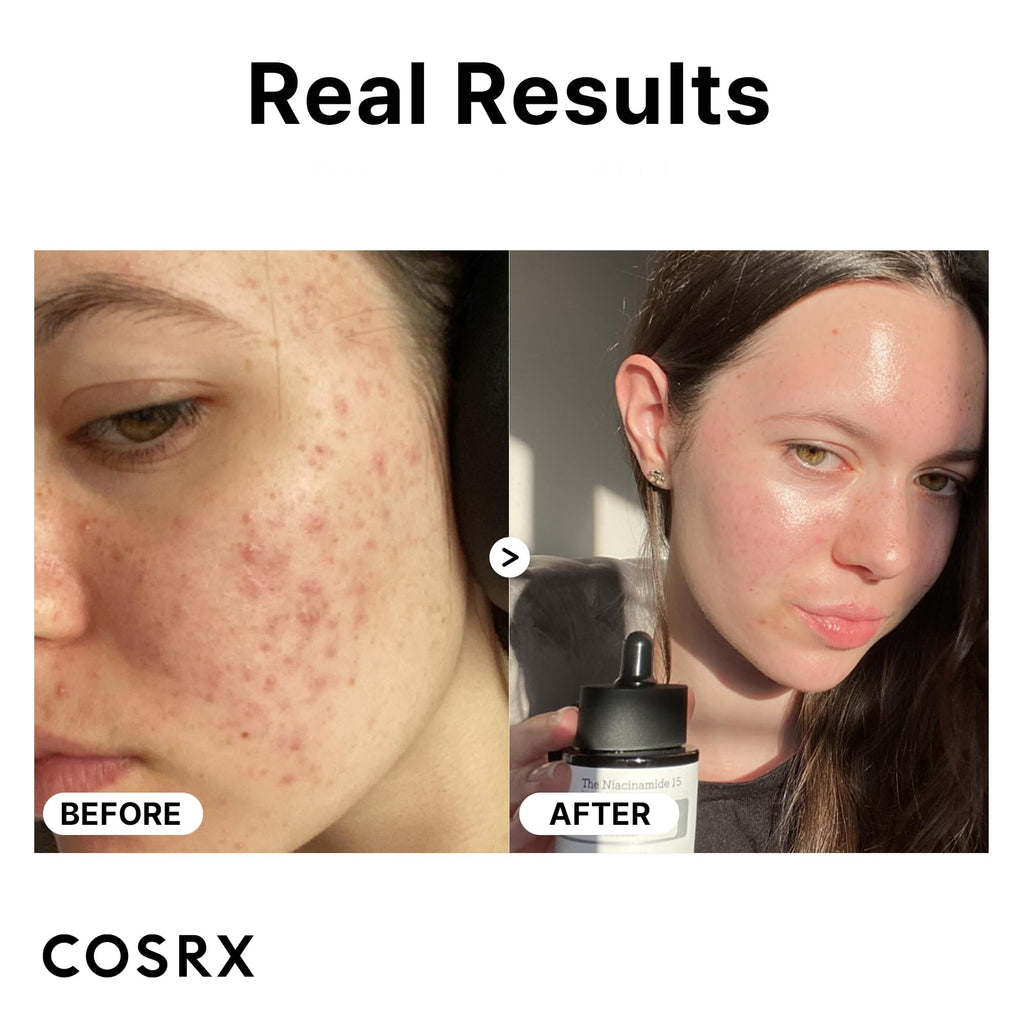 COSRX Serum Duo - 2% Alpha Arbutin Discoloration Care + 15% Niacinamide Face Serum