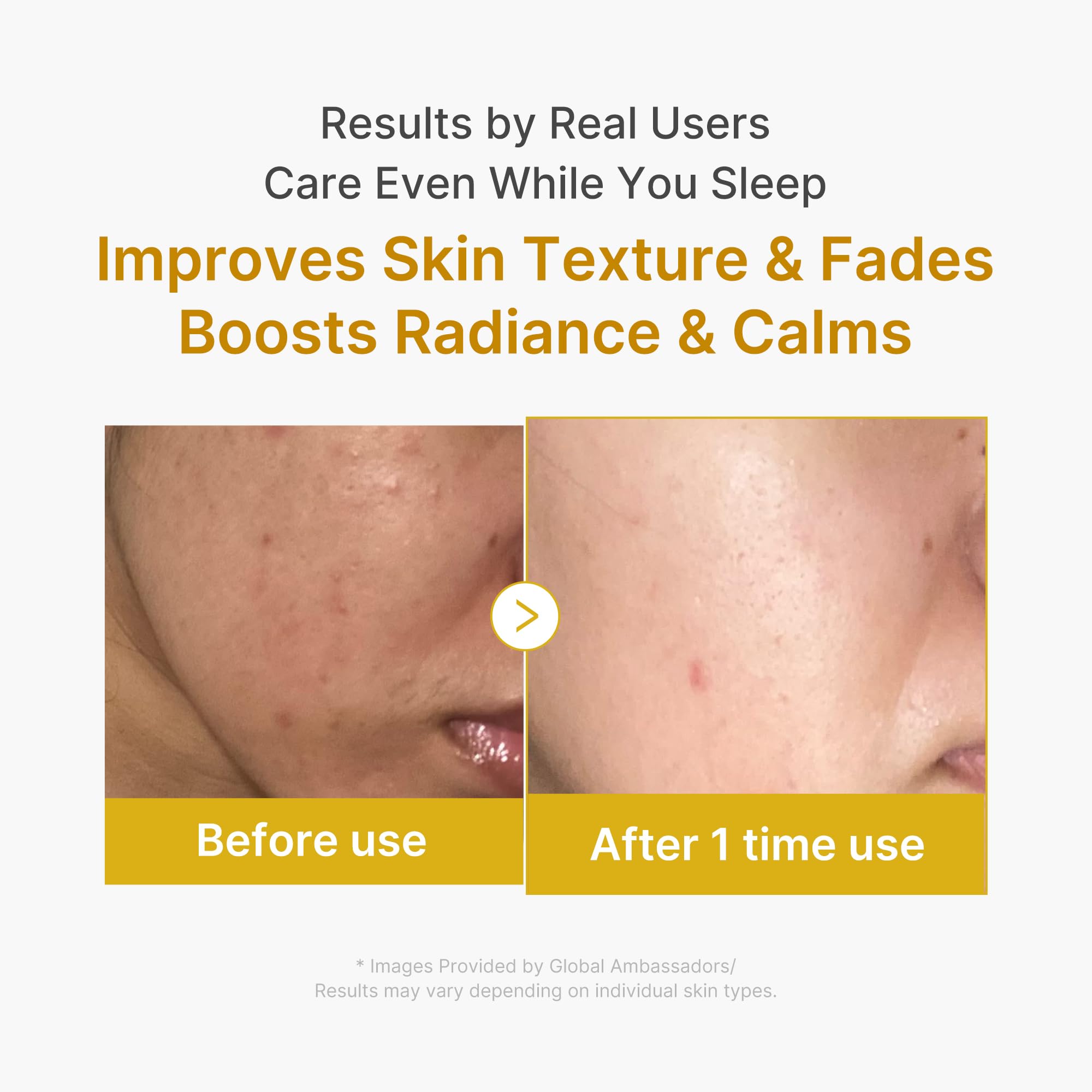 medicube Wrapping Mask Kojic Acid Turmeric- Overnight Peel Off Facial Mask
