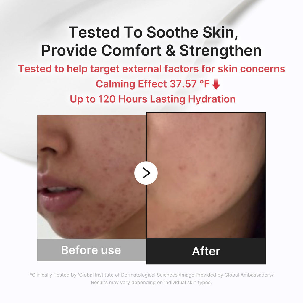 medicube 3H Daily Relief Cream for All Skin Types & After Spot Care