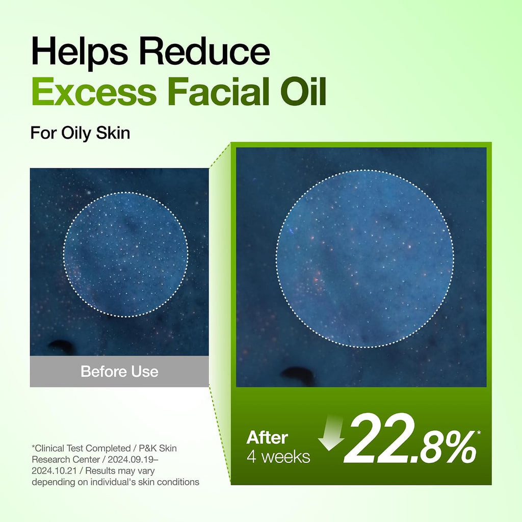 Anua Azelaic Acid 10 Hyaluron Redness Soothing Serum, 1.01 fl oz | Facial Serum for Blemish-Prone & Oily-Prone Skin, Lightweight & Hydrating Blemish Care, Hyaluronic Acid, Korean Skincare