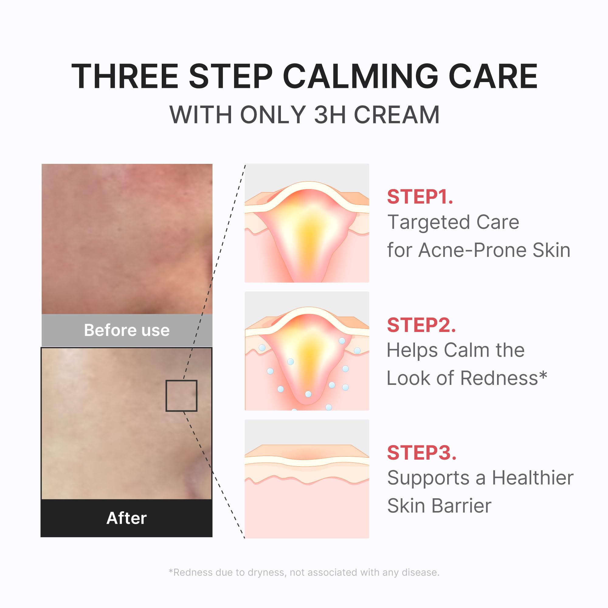 medicube 3H Daily Relief Cream for All Skin Types & After Spot Care