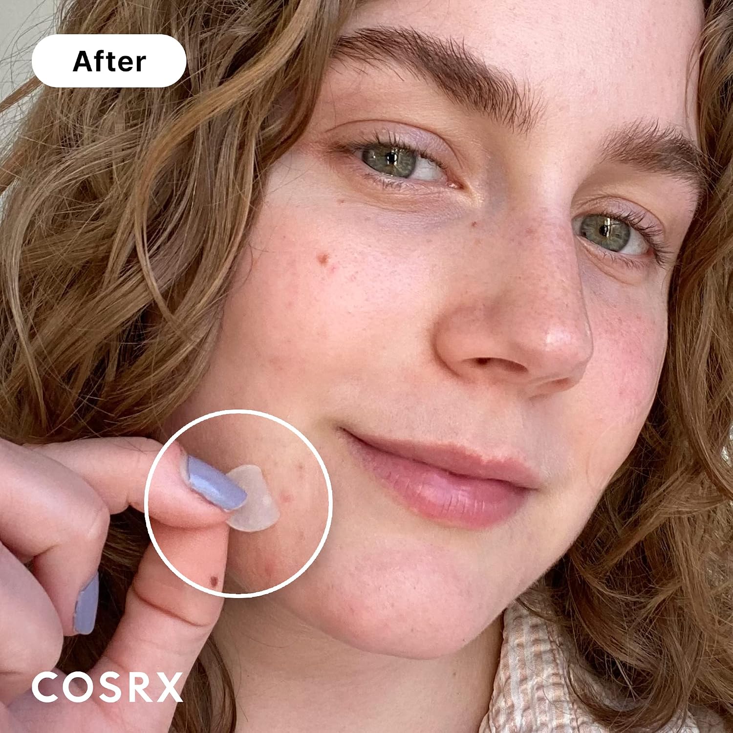 COSRX Acne Pimple Patches Absorbing Hydrocolloid Spot, 3 Size (72 Count) | Pimple Stickers for Blemishes and Zits Cover, Absorbs Zits & Blemish, Spot Stickers for Face and Body, Korean Skin Care