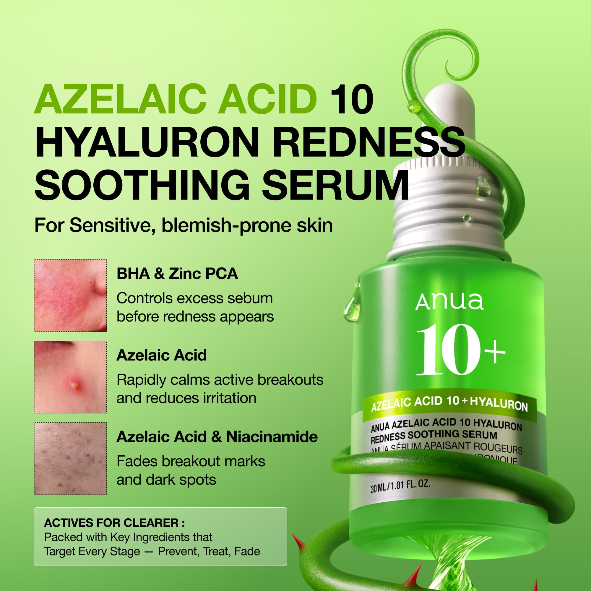 Anua Azelaic Acid 10 Hyaluron Redness Soothing Serum, 1.01 fl oz