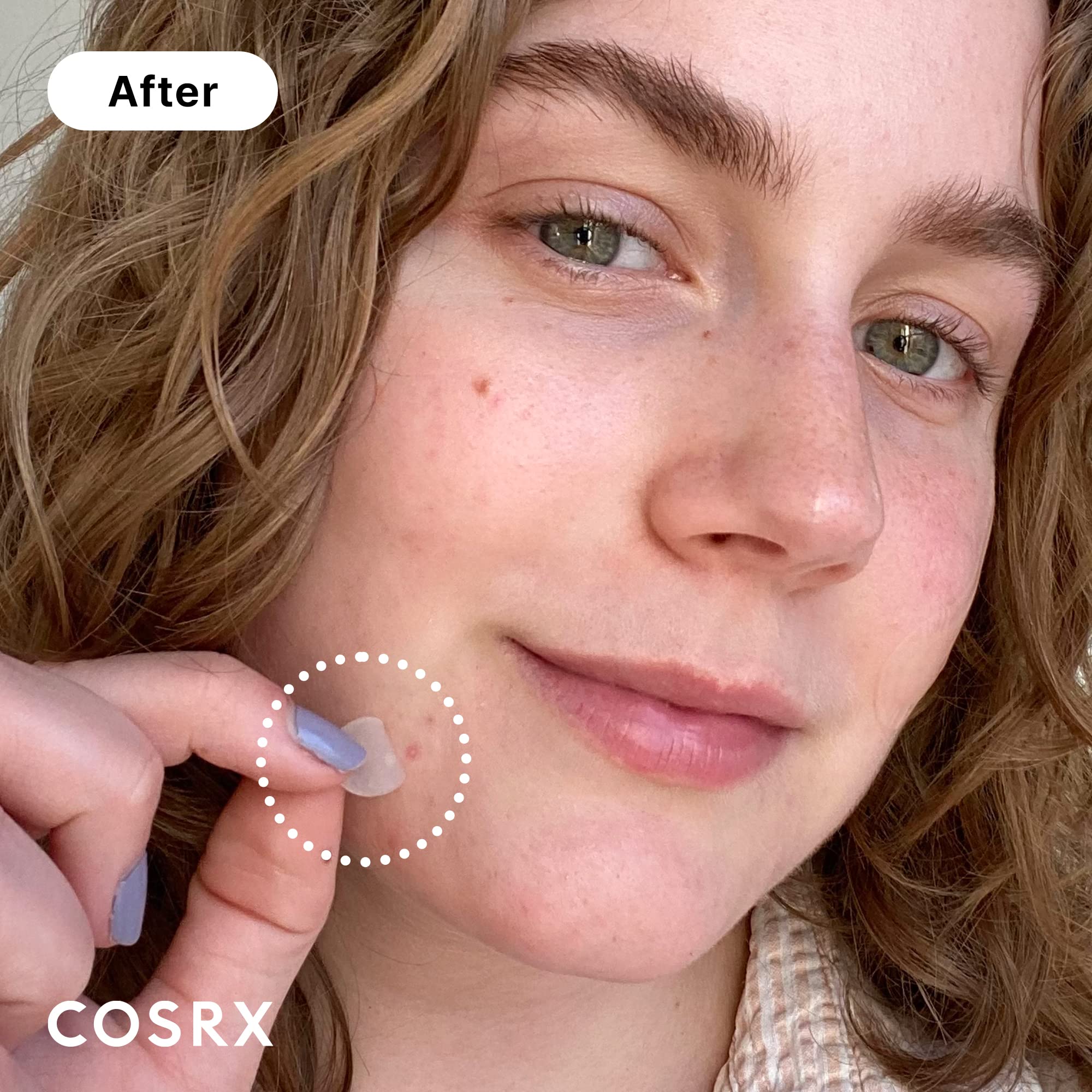 COSRX Acne Pimple Patches Absorbing Hydrocolloid Spot, 3 Size (72 Count) | Pimple Stickers for Blemishes and Zits Cover, Absorbs Zits & Blemish, Spot Stickers for Face and Body, Korean Skin Care